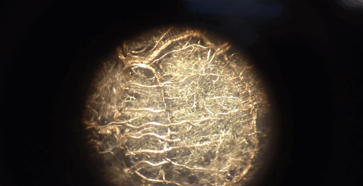 GoldschnittFroschgehirn